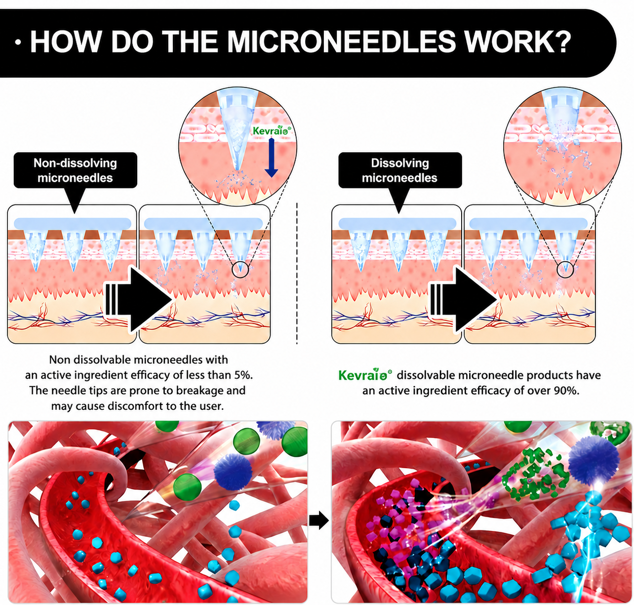 Doctor Recommended 🌟 | Kevrai® Berberine 10-in-1 Nano Microneedle Patch | ✅ 🥈🥈*R