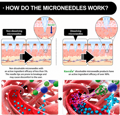 Doctor Recommended 🌟 | Kevrai® Berberine 10-in-1 Nano Microneedle Patch | ✅ 🥈🥈*R