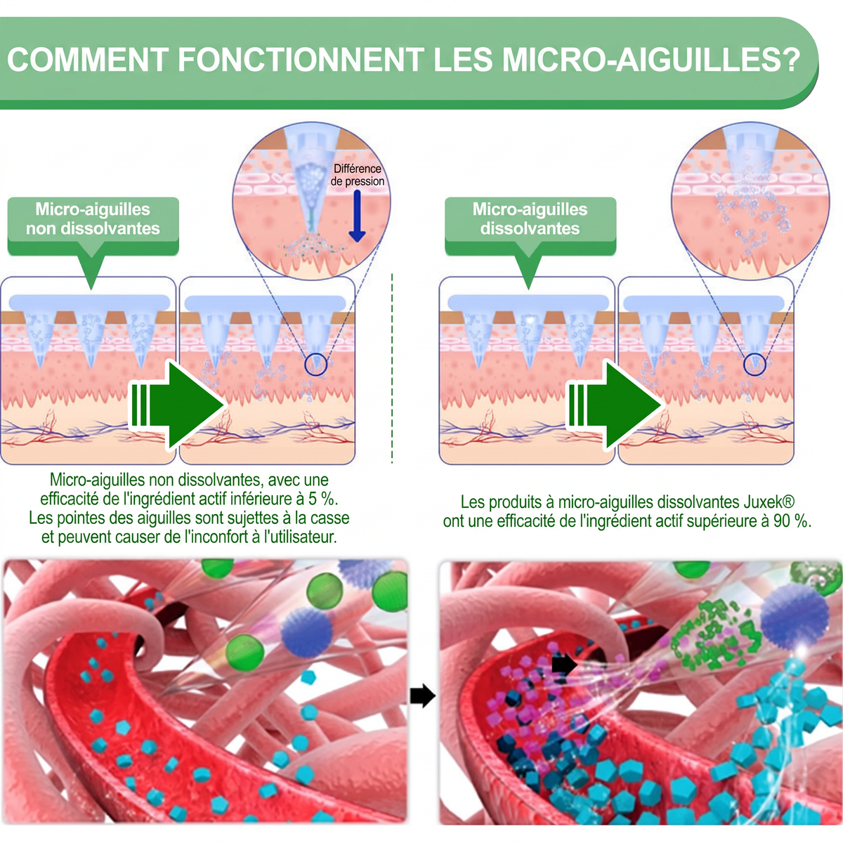 FR  Recommandé par des médecins 🌟 | Kevrai® Patch de micro-aiguilles nano à la berbérine 10-en-1 | ✅ Formule fondée sur la science | Complexe avancé 10-en-1 | Résultats visibles en 7 jours 🏅