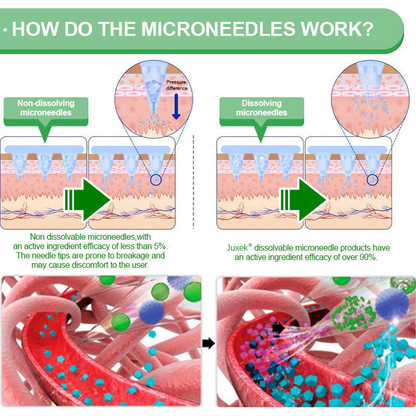 Patch minceur à micro-aiguilles à la berbérine | Soutien 10-en-1 à la gestion du poids